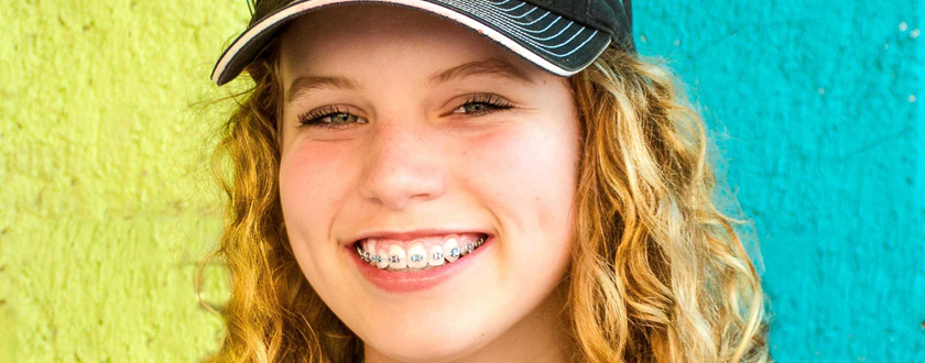 Woman smiling with braces